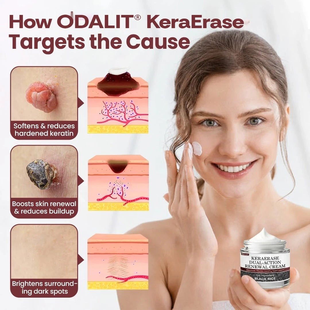 ODALIT®KeraErase Dual-Action Renewal Cream