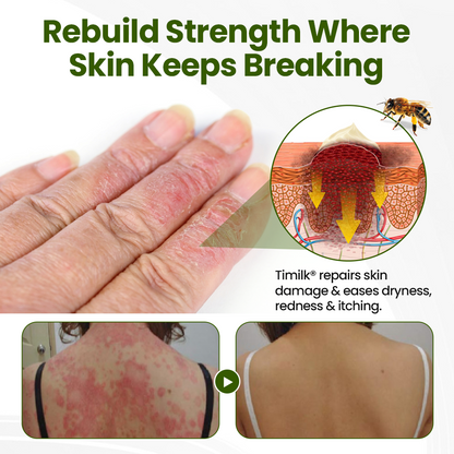 ODALIT® BeePeptide RootSoft DualRelief Cream
