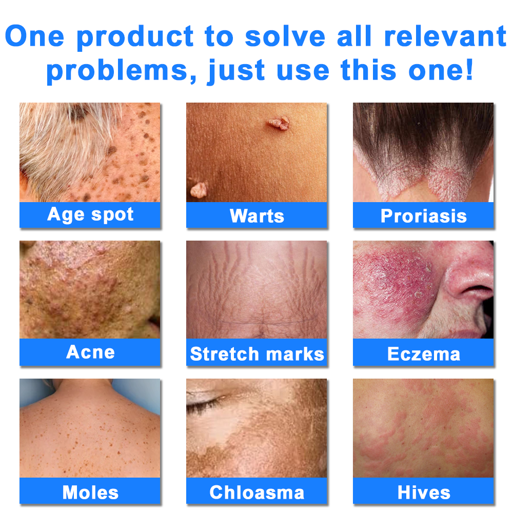 ODALIT™  OatCalm Skin Repair Cream Rx(Relieves eczema, itching , dermatitis, psoriasis, skin allergies,  pigmentation, dry skin, and other common skin issues)