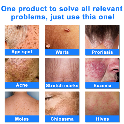 ODALIT™  OatCalm Skin Repair Cream Rx(Relieves eczema, itching , dermatitis, psoriasis, skin allergies,  pigmentation, dry skin, and other common skin issues)