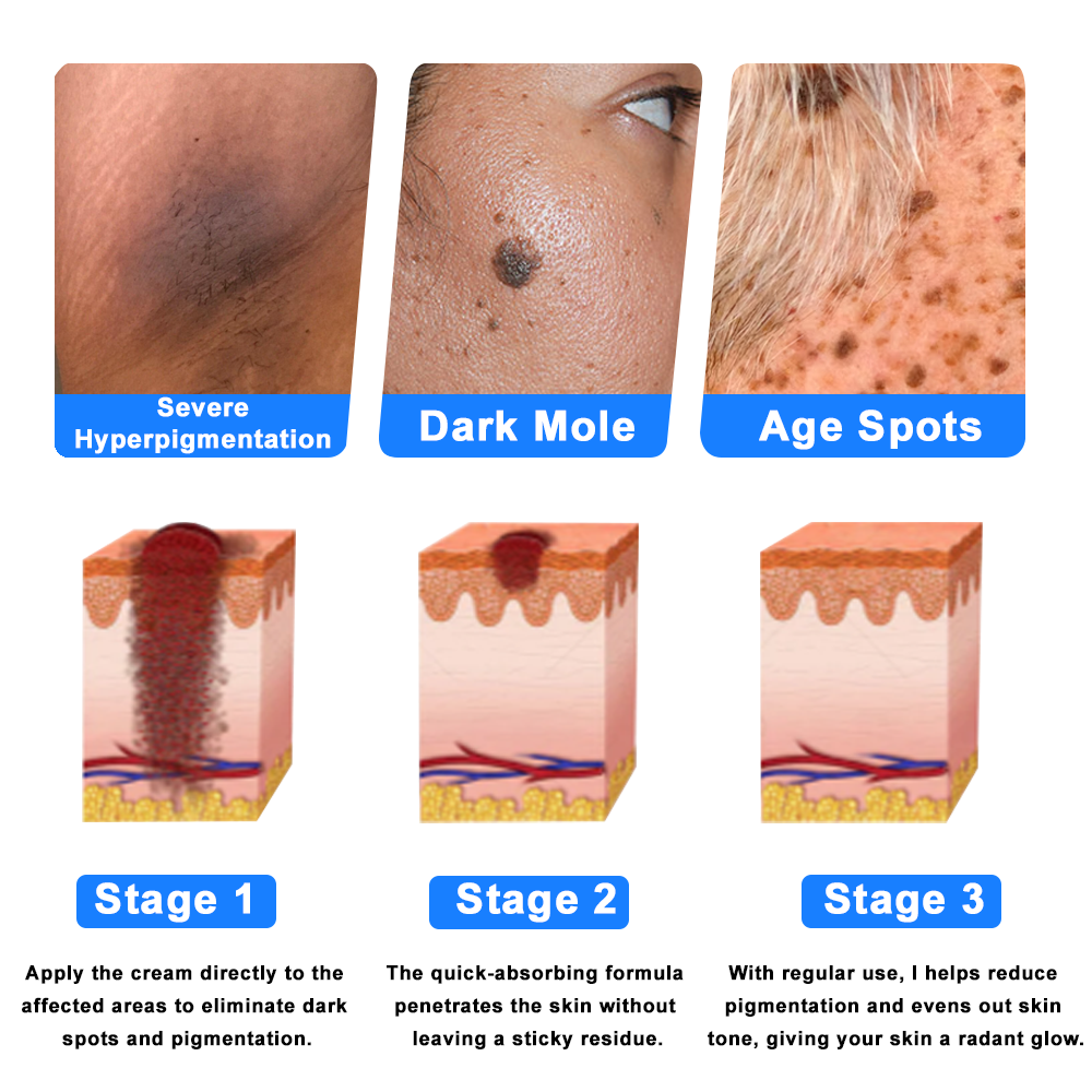 ODALIT™  OatCalm Skin Repair Cream Rx(Relieves eczema, itching , dermatitis, psoriasis, skin allergies,  pigmentation, dry skin, and other common skin issues)