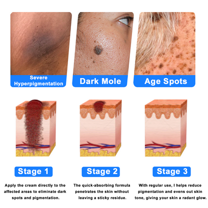 ODALIT™  OatCalm Skin Repair Cream Rx(Relieves eczema, itching , dermatitis, psoriasis, skin allergies,  pigmentation, dry skin, and other common skin issues)
