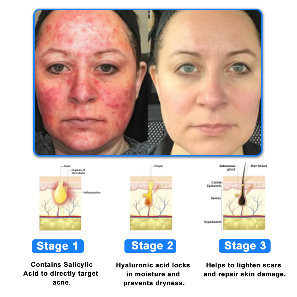 ODALIT™  OatCalm Skin Repair Cream Rx(Relieves eczema, itching , dermatitis, psoriasis, skin allergies,  pigmentation, dry skin, and other common skin issues)
