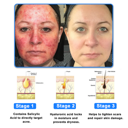 ODALIT™  OatCalm Skin Repair Cream Rx(Relieves eczema, itching , dermatitis, psoriasis, skin allergies,  pigmentation, dry skin, and other common skin issues)