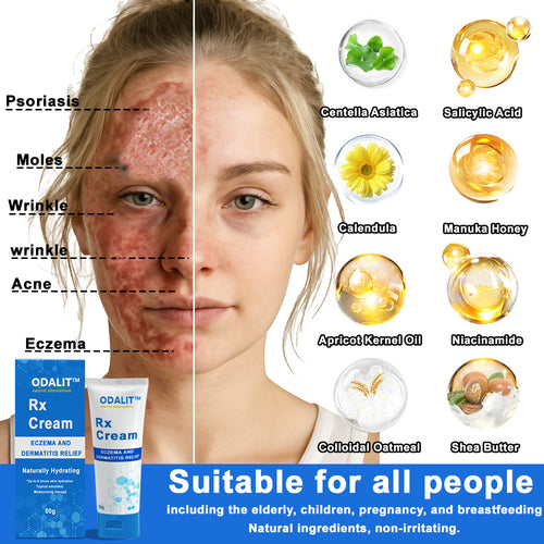 ODALIT™  OatCalm Skin Repair Cream Rx(Relieves eczema, itching , dermatitis, psoriasis, skin allergies,  pigmentation, dry skin, and other common skin issues)