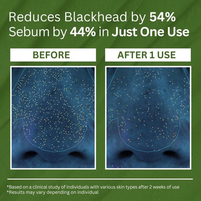 ODALIT Bubble Deep Cleansing Mask