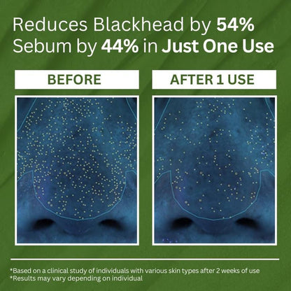 ODALIT Bubble Deep Cleansing Mask