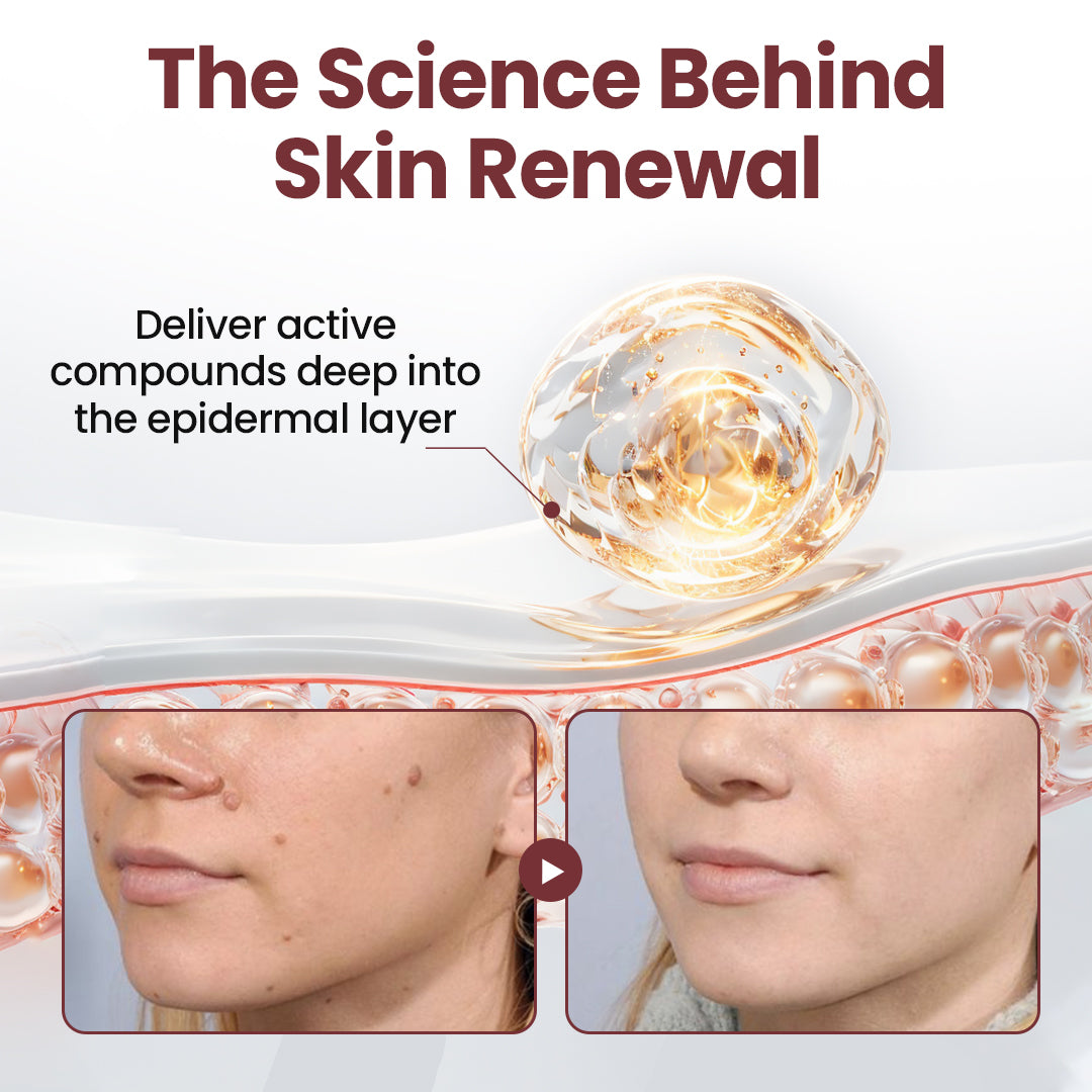 ODALIT®KeraErase Dual-Action Renewal Cream