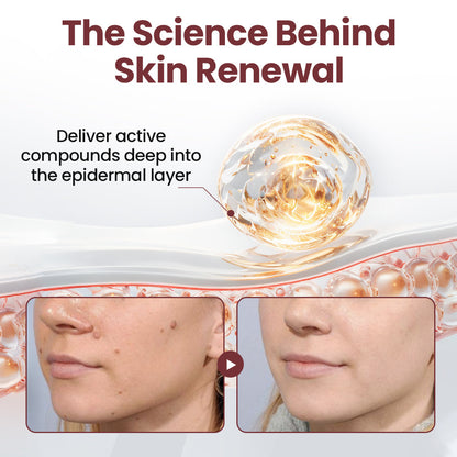 ODALIT®KeraErase Dual-Action Renewal Cream
