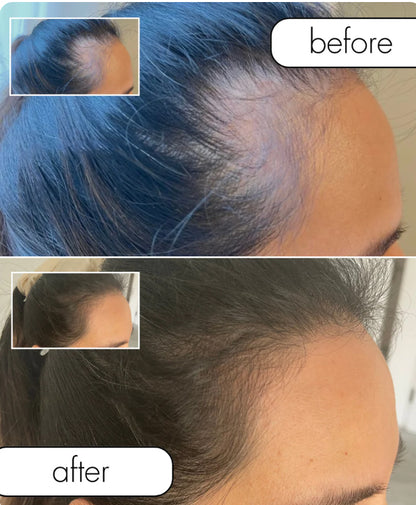 Custom Hair Growth Oil