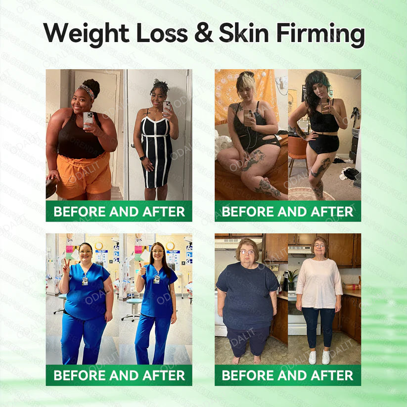 [FDA-Registered & Clinical support] 🇺🇸 ODALIT® L-Carnitine × Retinol | Slimming & Firming 2-in-1 Nano Microneedle Patch 🔥 Obesity, Diabetes, Sleep Apnea, And Joint Issues⏳