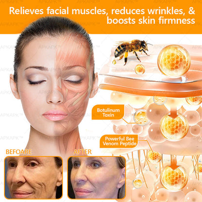 🎁Made and Shipped from USA ✨ ODALIT™ Bee venom Comprehensive Cream 🔥 LAST DAY 80% OFF 🐝💎