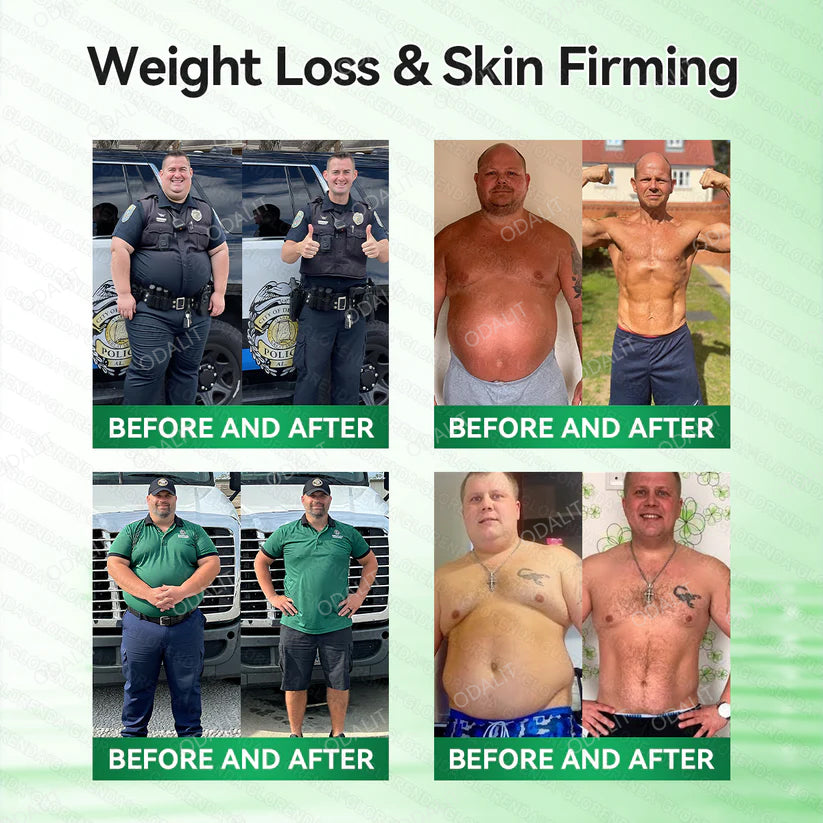 [FDA-Registered & Clinical support] 🇺🇸 ODALIT® L-Carnitine × Retinol | Slimming & Firming 2-in-1 Nano Microneedle Patch 🔥 Obesity, Diabetes, Sleep Apnea, And Joint Issues⏳