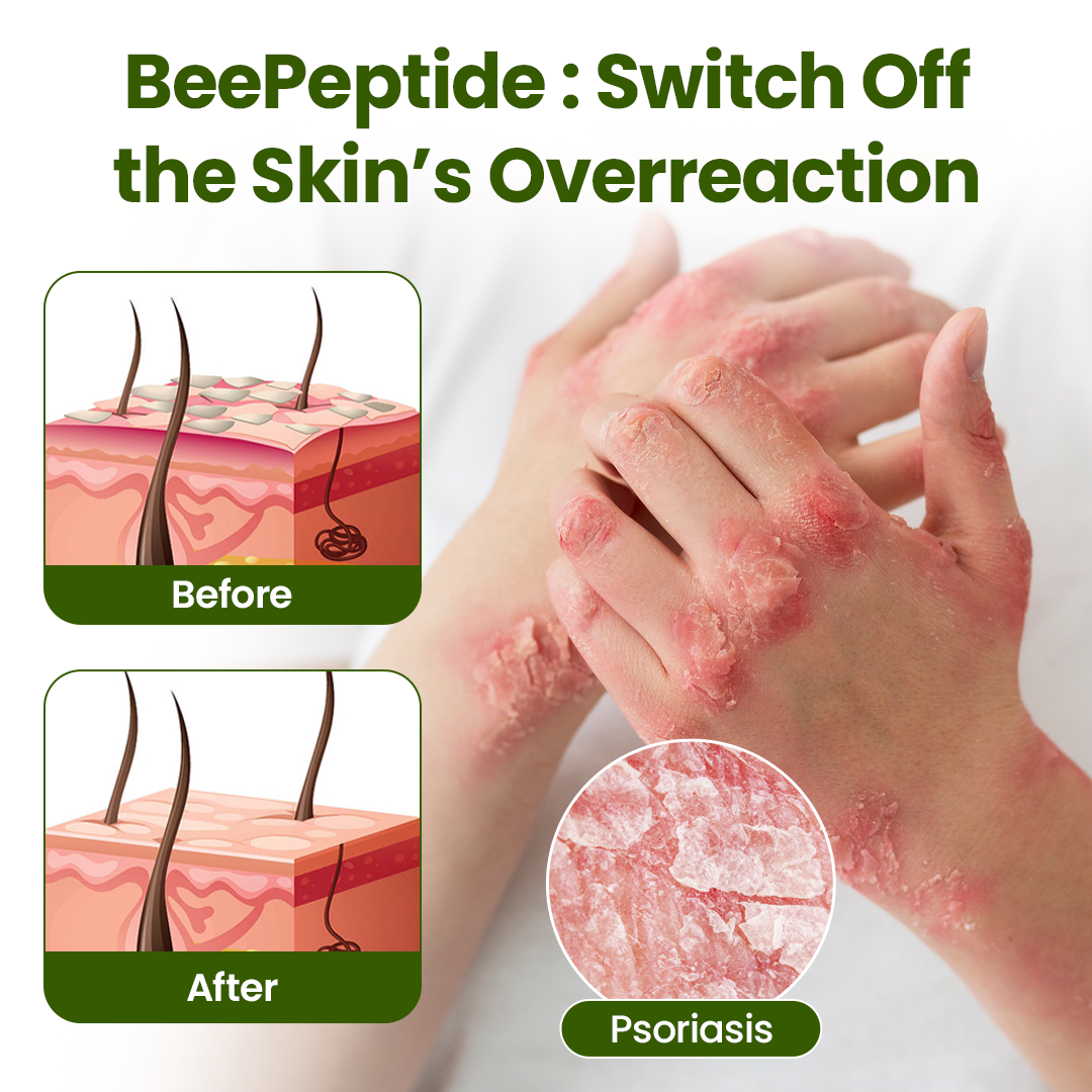 ODALIT® BeePeptide RootSoft DualRelief Cream