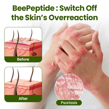 ODALIT® BeePeptide RootSoft DualRelief Cream