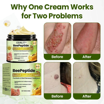 ODALIT® BeePeptide RootSoft DualRelief Cream