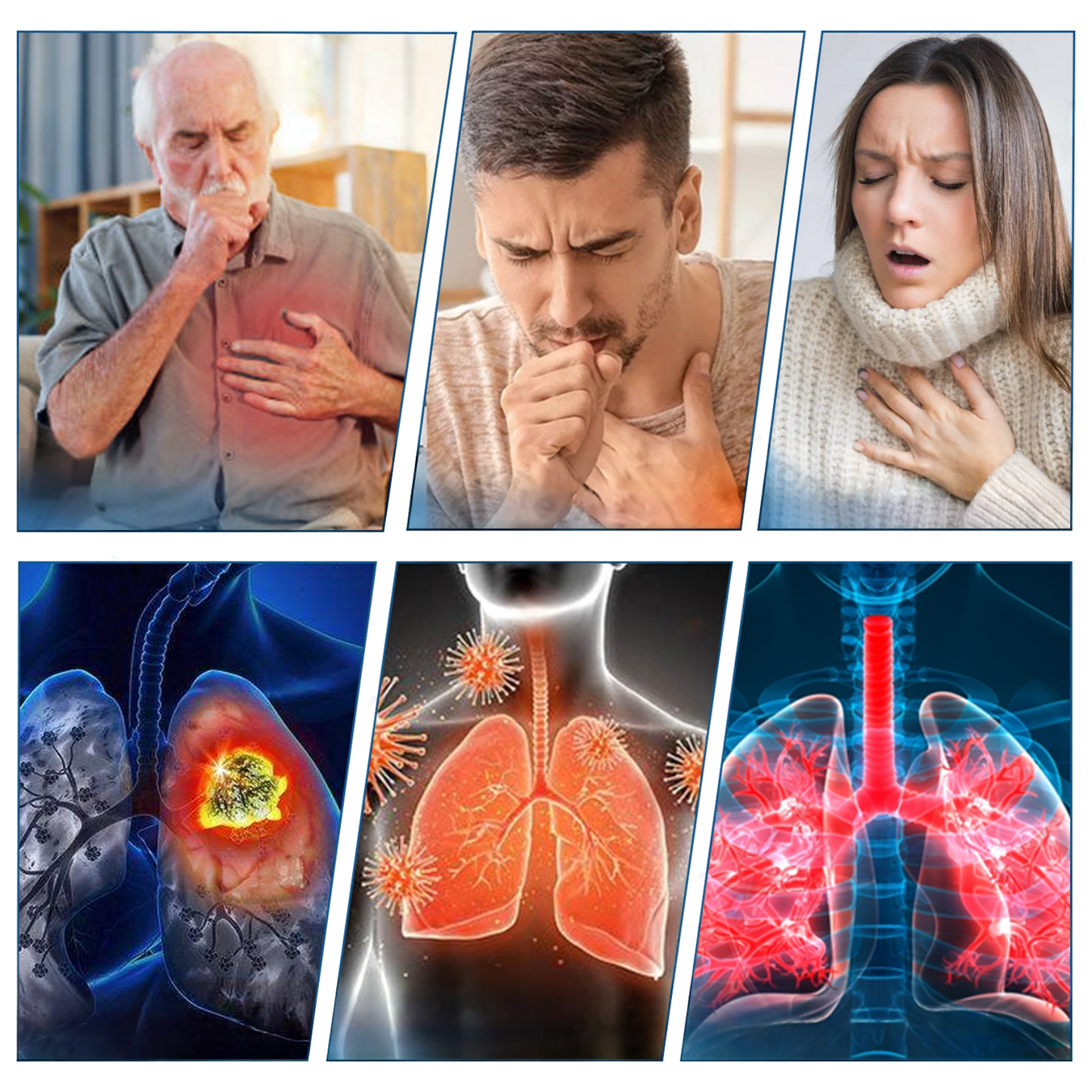 ✅ODALIT™ DoubleNano COPD Relief Patch (💝 Cough, wheezing, shortness of breath, sputum, stuffy nose, bronchitis, bronchitis, allergy symptoms, lung discomfort)